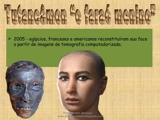  2005 - egípcios, franceses e americanos reconstituíram sua face
a partir de imagens de tomografia computadorizada.
Prof. Douglas Barraqui
www.dougnahistoria.blogspot.com
 