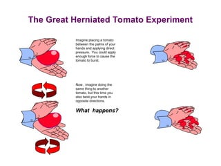 The Great Herniated Tomato Experiment
Imagine placing a tomato
between the palms of your
hands and applying direct
pressure. You could apply
enough force to cause the
tomato to burst.
Now , imagine doing the
same thing to another
tomato, but this time you
also twist your hands in
opposite directions.
What happens?
 