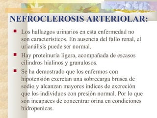 NEFROCLEROSIS ARTERIOLAR:
   Los hallazgos urinarios en esta enfermedad no
    son característicos. En ausencia del fallo renal, el
    urianálisis puede ser normal.
   Hay proteinuría ligera, acompañada de escasos
    cilindros hialinos y granulosos.
   Se ha demostrado que los enfermos con
    hipotensión excretan una sobrecarga brusca de
    sodio y alcanzan mayores índices de excreción
    que los individuos con presión normal. Por lo que
    son incapaces de concentrar orina en condiciones
    hidropenicas.
 