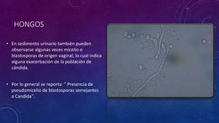 HONGOS
• En sedimento urinario también pueden
observarse algunas veces micelio o
blastosporas de origen vaginal, lo cual indica
alguna exacerbación de la población de
cándida.
• Por lo general se reporta: " Presencia de
pseudomicelio de blastosporas semejantes
a Candida".
 