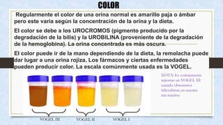 COLOR
Regularmente el color de una orina normal es amarillo paja o ámbar
pero este varia según la concentración de la orina y la dieta.
El color se debe a los UROCROMOS (pigmento producido por la
degradación de la bilis) y la UROBILINA (proveniente de la degradación
de la hemoglobina). La orina concentrada es más oscura.
El color puede ir de la mano dependiendo de la dieta, la remolacha puede
dar lugar a una orina rojiza. Los fármacos y ciertas enfermedades
pueden producir color. La escala comúnmente usada es la VOGEL.
VOGEL III VOGEL II VOGEL I
NOTA: Es comúnmente
reportar un VOGEL III
cuando obtenemos
bilirrubinas en nuestra
tira reactiva
 