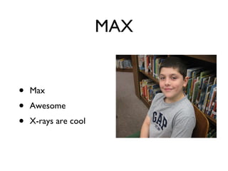 MAX Max Awesome  X-rays are cool 