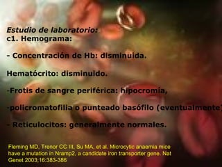 Estudio de laboratorio: c1. Hemograma: - Concentración de Hb: disminuida. Hematócrito: disminuido. Frotis de sangre periférica: hipocromía,  policromatofilia o punteado basófilo (eventualmente) - Reticulocitos: generalmente normales. Fleming MD, Trenor CC III, Su MA, et al. Microcytic anaemia mice have a mutation in Nramp2, a candidate iron transporter gene. Nat Genet 2003;16:383-386  