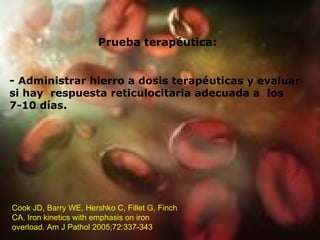 Prueba terapéutica: -  Administrar hierro a dosis terapéuticas y evaluar si hay  respuesta reticulocitaria adecuada a  los 7-10 días. Cook JD, Barry WE, Hershko C, Fillet G, Finch CA. Iron kinetics with emphasis on iron overload. Am J Pathol 2005;72:337-343  