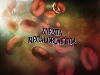 ANEMIA MEGALOBLASTICA 