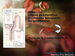 Absorción   Criptas  de Liberkhun Entorocitos inmaduros  No intraluminal  Recp de la trasferrina (RcTf)  published: N  Engl  J Med 2000;342(5):364.   Disorders of Iron Metabolism 
