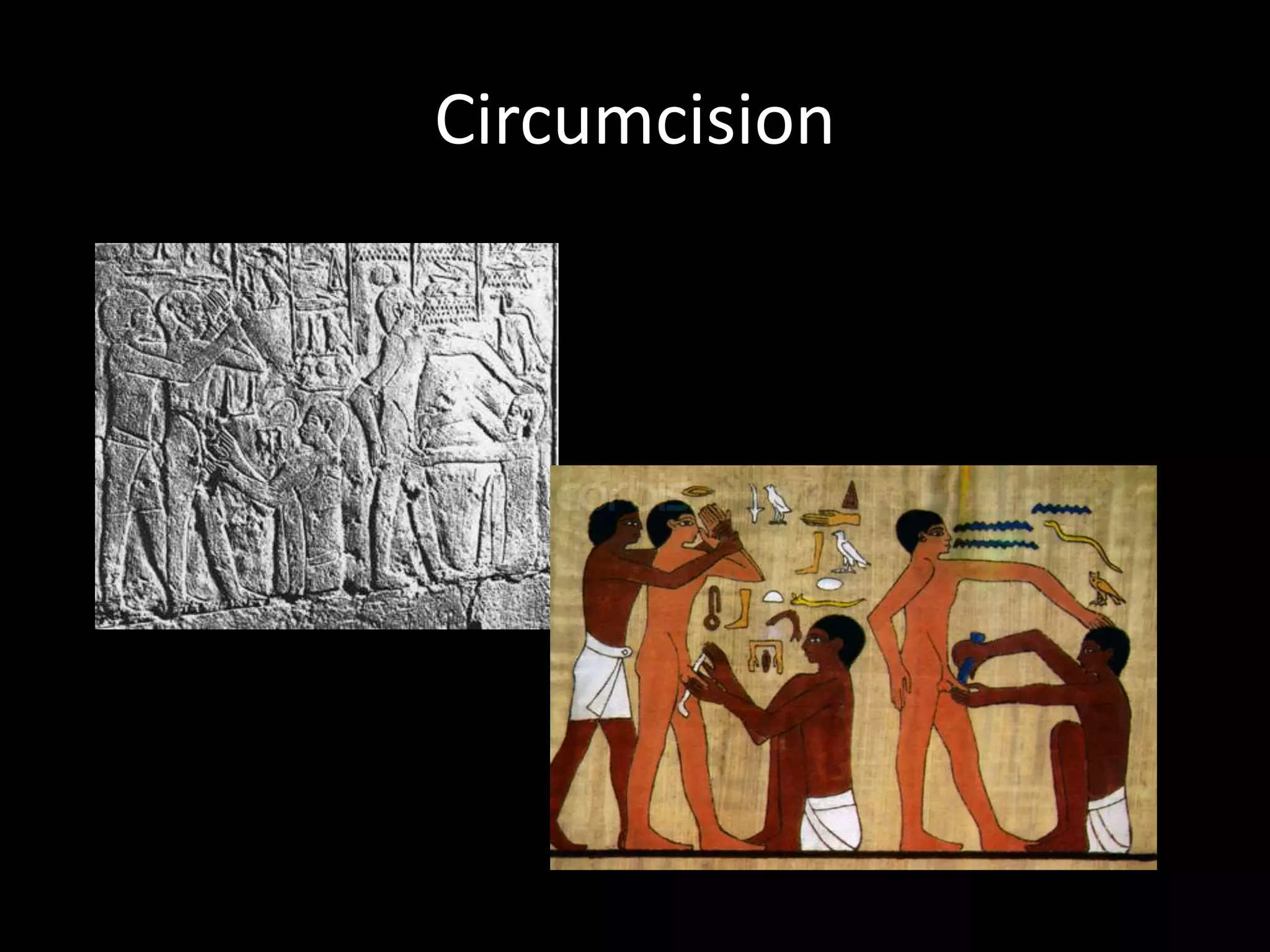 Circumcision
