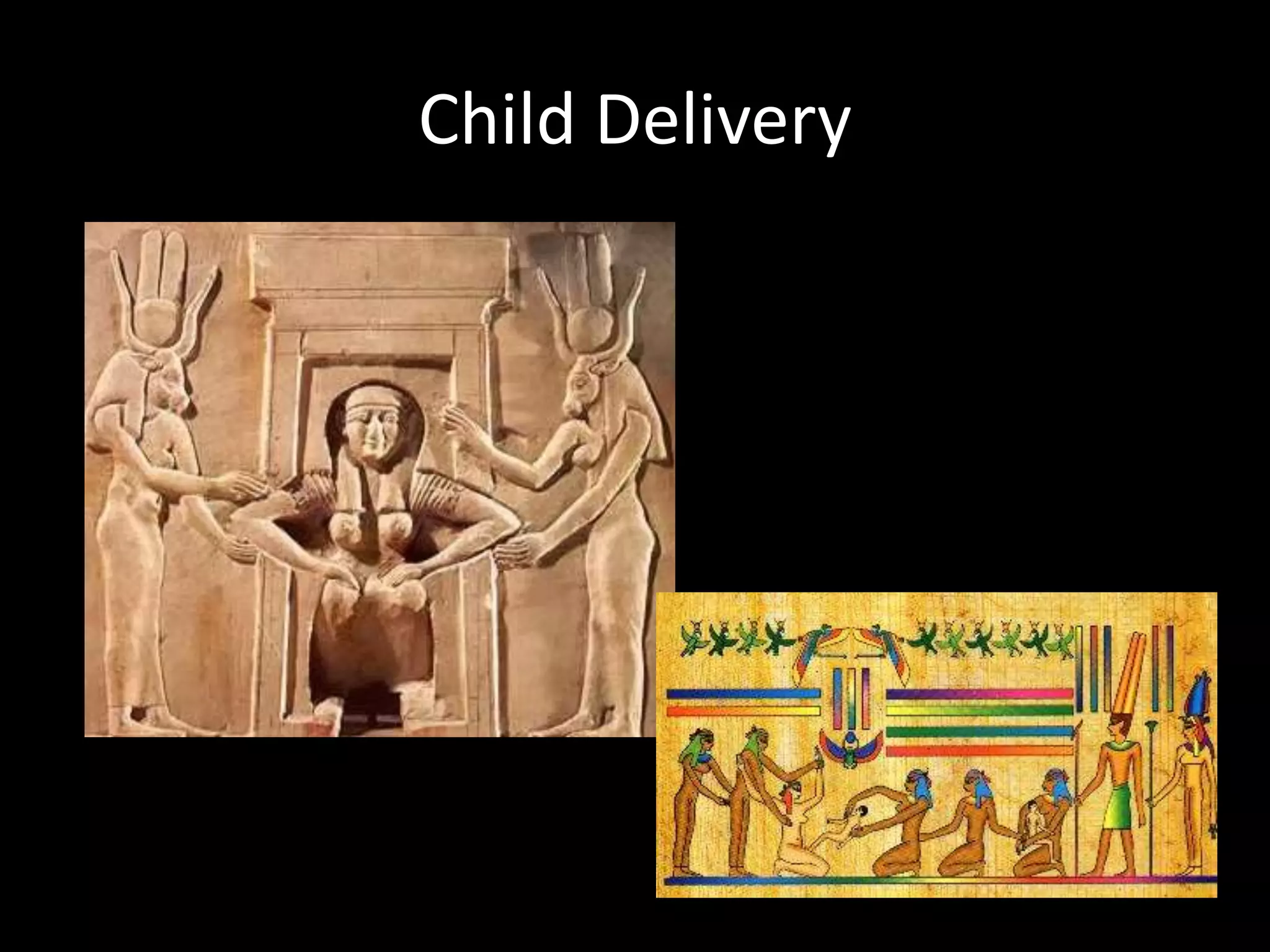 Child Delivery