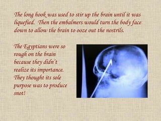 The long hook was used to stir up the brain until it was
liquefied. Then the embalmers would turn the body face
down to allow the brain to ooze out the nostrils.
The Egyptians were so
rough on the brain
because they didn’t
realize its importance.
They thought its sole
purpose was to produce
snot!
 