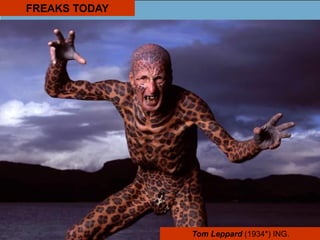 FREAKS TODAY
Tom Leppard (1934*) ING.
 