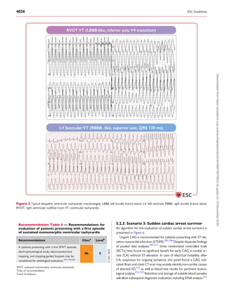 Svt Management Pdf guidelines management ventricular tachycardia.pdf