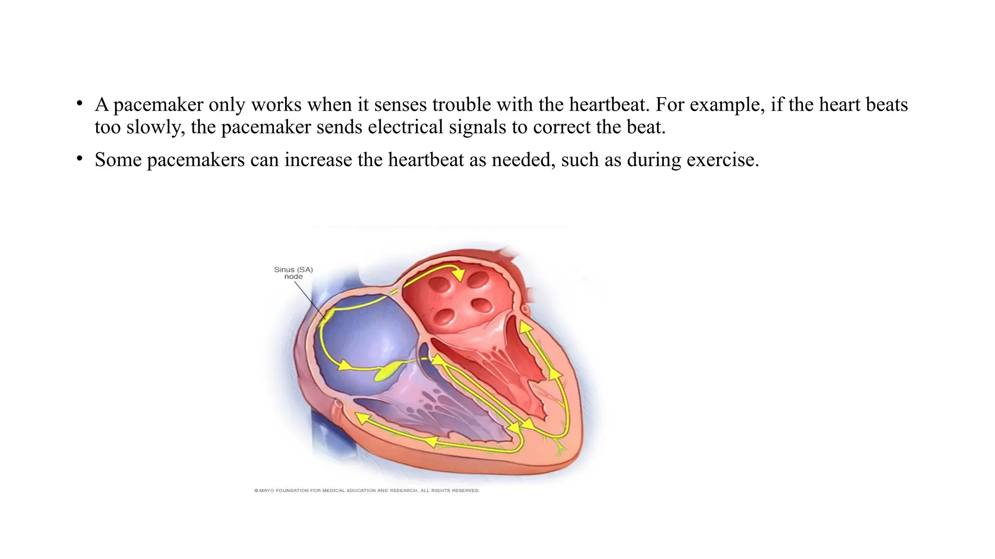 • A pacemaker only works when it senses trouble with the heartbeat. For example, if the heart beats
too slowly, the pacemaker sends electrical signals to correct the beat.
• Some pacemakers can increase the heartbeat as needed, such as during exercise.
 