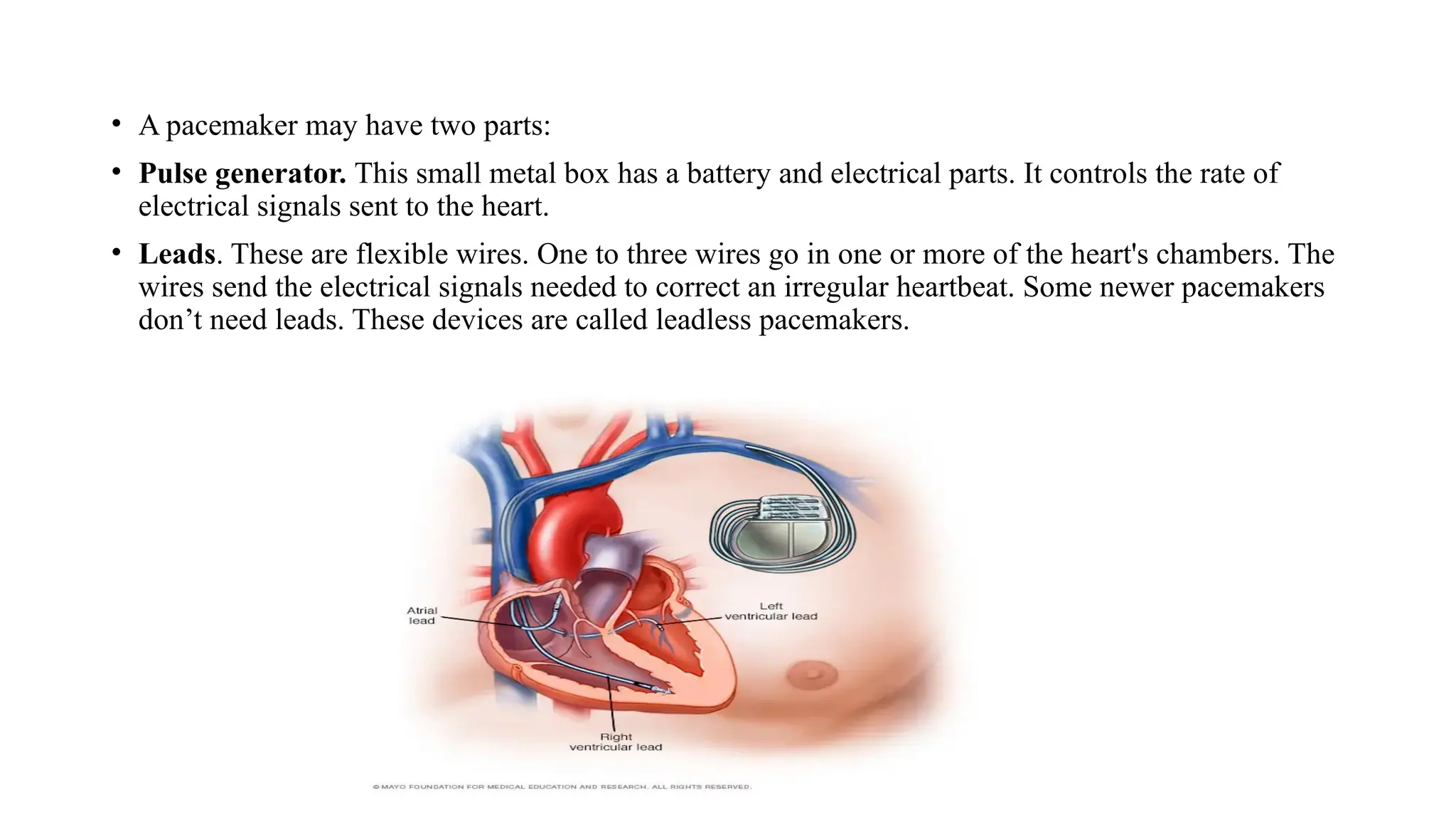 • A pacemaker may have two parts:
• Pulse generator. This small metal box has a battery and electrical parts. It controls the rate of
electrical signals sent to the heart.
• Leads. These are flexible wires. One to three wires go in one or more of the heart's chambers. The
wires send the electrical signals needed to correct an irregular heartbeat. Some newer pacemakers
don’t need leads. These devices are called leadless pacemakers.
 