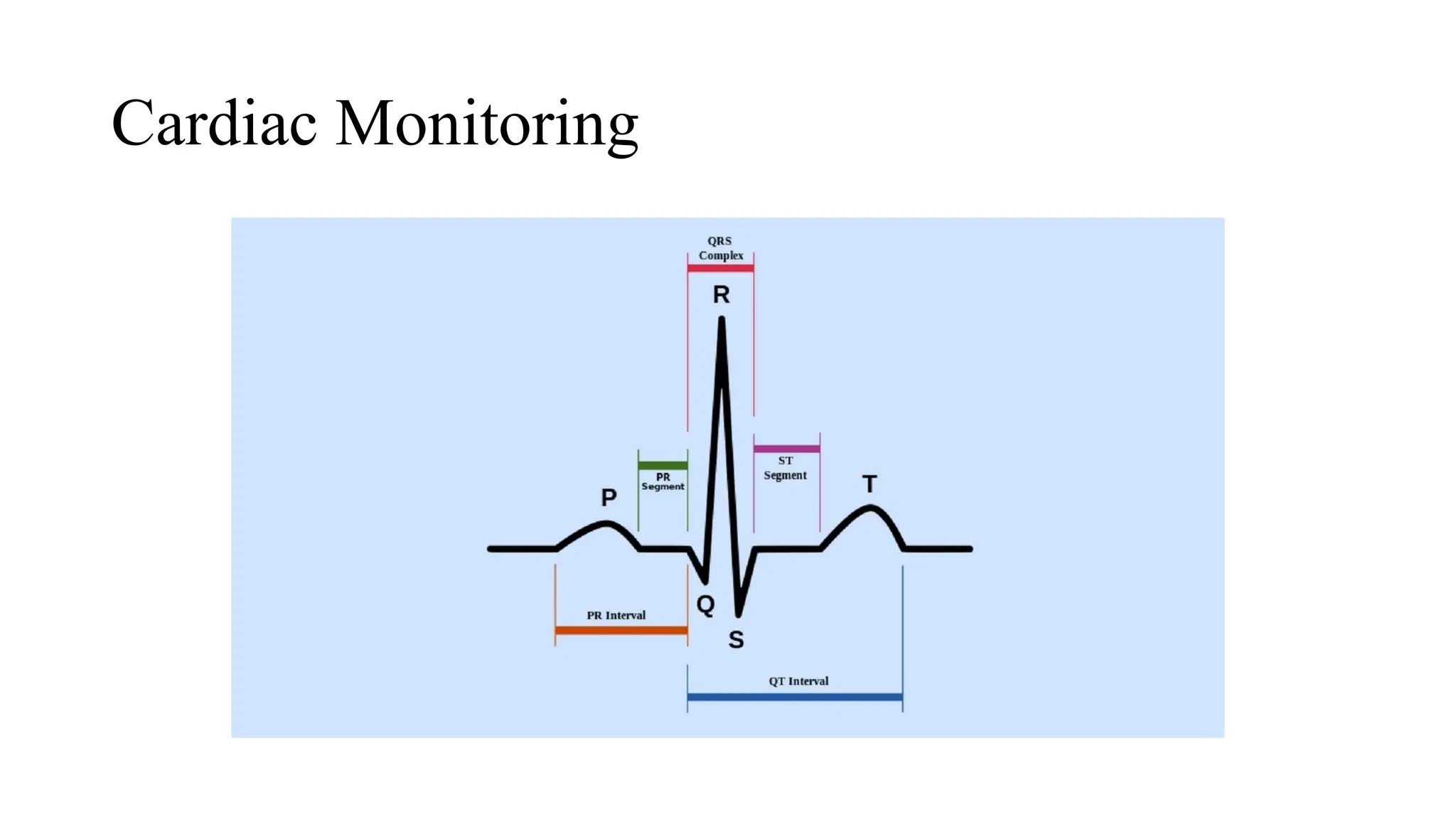 Cardiac Monitoring
 
