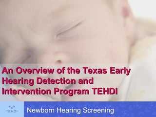 An Overview of the Texas Early Hearing Detection and Intervention Program TEHDI Newborn Hearing Screening 