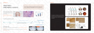 EHL
BIO
치매 예방 및 치료
Ⅳ injection to tail vein(13 times, 2 weeks apart)
① Tg2576 mouse (Alzheimer model)
Birth 14
months
13
months
10 months
13th
injection
3 months old
1st injection
② Morris water maze
3 months after
Comparing test in behavioral function
Comparing test in pathological status
실험에서 치매 상태인 쥐는 수조에서 받침대를 기억하지 못해 계속해서 헤엄쳤으나(좌측), 줄기세포 시술을 받은 쥐는 바로 받침대를 찾는 것
이 보입니다.(우측)
위 실험에서 줄기세포 시술 후 실험 쥐의 인지 및 신체기능은 23.4%, Lifespan(수명) 31.3%가 증가된 것으로 나타나 치매 치료에 줄기세포의
이용이 효과적임을 알 수 있습니다.
기억을 관장하는 해마나 언어중추인 대뇌피질이 파괴
되어 인지 및 언어장애을 유발하는 알츠하이머 치매의
원인은 아밀로이드플라크(가운데 사진의 붉은색 플라
크)로 알려져 있습니다.
현재, 아미로이드 플라크를 녹이는 약은 개발되지 않
았지만 줄기세포는 이것을 녹이는 것으로 알려져 있습
니다.
Before After
Number
of
Plaques
Per
a
Slice
of
Tissue
Hippo
0
2
4
6
8
10
Cortex Total
Tg-sham Tg-ASC
Normal Alzheimer's
Language
Language
Memory
Memory
출처 <Kanninen K et al. (2009) Proceedings of the National Academy of Sciences>
출처 <PLOS ONE 7 (2012) e45757>
지방줄기세포는
치매를 예방하고 치료합니다.
줄기세포 시술 전과 후의 대뇌 중요 부위에서 아밀로이드 플라크가 감소한 것을 알 수 있으며,
줄기세포는 치매증상을 개선하거나 진행을 억제하는 데 효과가 있는 것으로 알려져 있습니다.
35
파킨슨병 치료
EHL
BIO
정상 뇌 흑질
파킨슨병 환자의 뇌 흑질
Tremor
ofthehands
evenatrest
Persistenttremors
Shufflinggait,
unbalanced
andinsmallsteps,
curvedina
characteristicway
투여 6개월 후에 LPS 투여군보다 LPS+rADSC 투여군에서
도파민 세포(TH-positive cells)가 많이 보이며, 이는 LPS에
의한 도파민세포의 손상이 rADSC에 의하여 줄어들었다는
것을 의미한다.
36
 