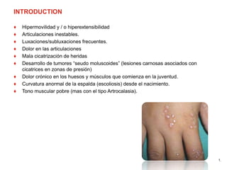 INTRODUCTION
♦ Hipermovilidad y / o hiperextensibilidad
♦ Articulaciones inestables.
♦ Luxaciones/subluxaciones frecuentes.
♦ Dolor en las articulaciones
♦ Mala cicatrización de heridas
♦ Desarrollo de tumores “seudo moluscoides” (lesiones carnosas asociados con
cicatrices en zonas de presión)
♦ Dolor crónico en los huesos y músculos que comienza en la juventud.
♦ Curvatura anormal de la espalda (escoliosis) desde el nacimiento.
♦ Tono muscular pobre (mas con el tipo Artrocalasia).
1.
 