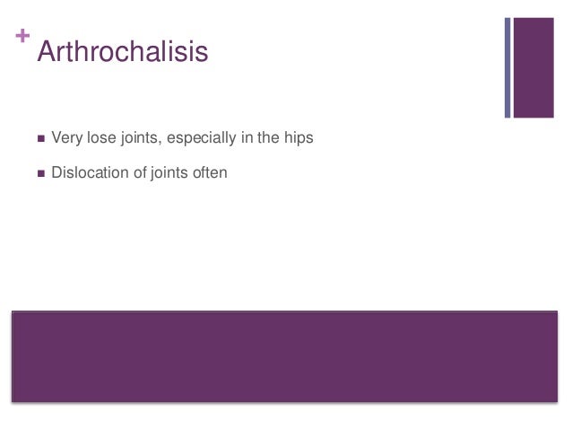 Ehlers Danlos Syndrome