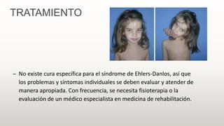 TRATAMIENTO
– No existe cura específica para el síndrome de Ehlers-Danlos, así que
los problemas y síntomas individuales se deben evaluar y atender de
manera apropiada. Con frecuencia, se necesita fisioterapia o la
evaluación de un médico especialista en medicina de rehabilitación.
 