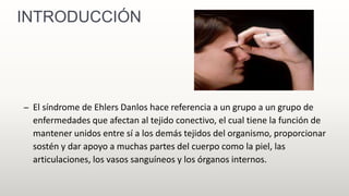 INTRODUCCIÓN
– El síndrome de Ehlers Danlos hace referencia a un grupo a un grupo de
enfermedades que afectan al tejido conectivo, el cual tiene la función de
mantener unidos entre sí a los demás tejidos del organismo, proporcionar
sostén y dar apoyo a muchas partes del cuerpo como la piel, las
articulaciones, los vasos sanguíneos y los órganos internos.
 