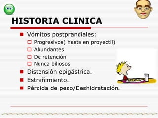 Diagrama de un estómago con una estenosis pilórica. Fíjese en el corte transversal mostrando el estrechamiento de la abertura pilórica.