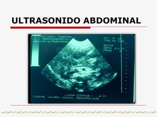2da, Post ingesta inmediata del medio de contraste. En esta se verá triple nivel (signo de la bandera). De arriba hacia abajo: aire, moco, bario.