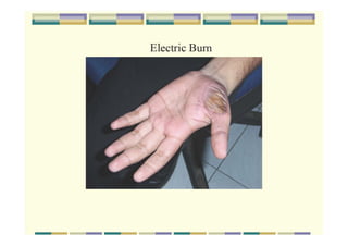 BOHS_Occupational Health in-construction-sector