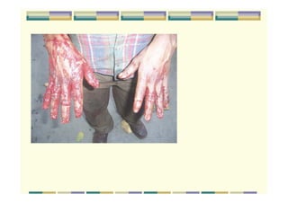 BOHS_Occupational Health in-construction-sector