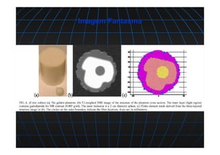 Imagem Fantasma
figura
 
