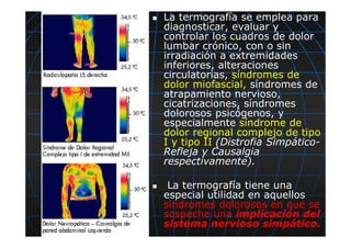 La termografía se emplea para
diagnosticar, evaluar y
controlar los cuadros de dolor
lumbar crónico, con o sin
irradiación a extremidades
inferiores, alteraciones
circulatorias, síndromes de
dolor miofascial, síndromes de
atrapamiento nervioso,
cicatrizaciones, síndromes
dolorosos psicógenos, y
especialmente síndrome de
dolor regional complejo de tipo
I y tipo II (Distrofia Simpático-
Refleja y Causalgia
respectivamente).
La termografía tiene una
especial utilidad en aquellos
síndromes dolorosos en que se
sospeche una implicación del
sistema nervioso simpático.
 