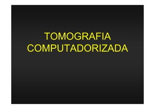 TOMOGRAFIA
COMPUTADORIZADA
 