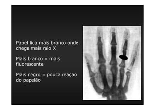 Papel fica mais branco onde
chega mais raio X
Mais branco = mais
fluorescente
Mais negro = pouca reação
do papelão
 
