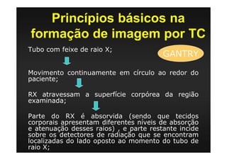 Princípios básicos na
formação de imagem por TC
Tubo com feixe de raio X;
Movimento continuamente em círculo ao redor do
paciente;
RX atravessam a superfície corpórea da região
examinada;
Parte do RX é absorvida (sendo que tecidos
corporais apresentam diferentes níveis de absorção
e atenuação desses raios) , e parte restante incide
sobre os detectores de radiação que se encontram
localizadas do lado oposto ao momento do tubo de
raio X;
GANTRY
 