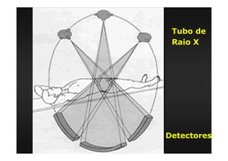 Tubo de
Raio X
Detectores
 