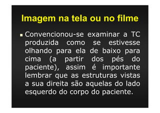 Imagem na tela ou no filme
Convencionou-se examinar a TC
produzida como se estivesse
olhando para ela de baixo para
cima (a partir dos pés do
paciente), assim é importante
lembrar que as estruturas vistas
a sua direita são aquelas do lado
esquerdo do corpo do paciente.
 