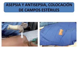 ASEPSIA Y ANTISEPSIA, COLOCACIÓN
DE CAMPOS ESTÉRILES
 