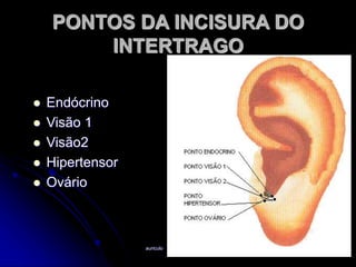 PONTOS DA INCISURA DO 
INTERTRAGO 
auriculo introdução chum 27 
 Endócrino 
 Visão 1 
 Visão2 
 Hipertensor 
 Ovário 
 