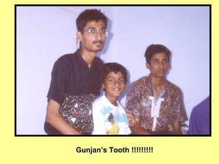 Gunjan’s Tooth !!!!!!!!!
 