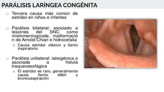PARÁLISIS LARÍNGEA CONGÉNITA
 