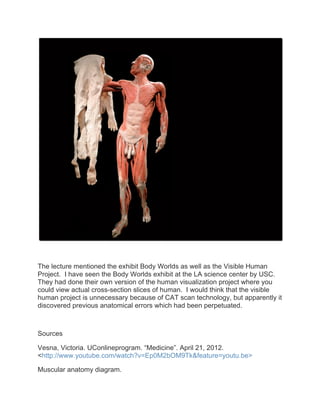 The lecture mentioned the exhibit Body Worlds as well as the Visible Human
Project. I have seen the Body Worlds exhibit at the LA science center by USC.
They had done their own version of the human visualization project where you
could view actual cross-section slices of human. I would think that the visible
human project is unnecessary because of CAT scan technology, but apparently it
discovered previous anatomical errors which had been perpetuated.



Sources

Vesna, Victoria. UConlineprogram. “Medicine”. April 21, 2012.
<http://www.youtube.com/watch?v=Ep0M2bOM9Tk&feature=youtu.be>

Muscular anatomy diagram.
 