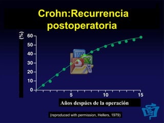 Crohn:Recurrencia
postoperatoria
(reproduced with permission, Hellers, 1979)
Años despúes de la operación
 