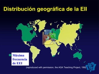 (reproduced with permission, the AGA Teaching Project, 1992)
Distribución geográfica de la EII
Máxima
frecuencia
de EEI
 