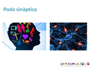 Poda sinàptica
 