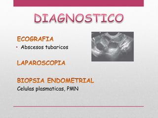 • Abscesos tubaricos
Celulas plasmaticas, PMN
 