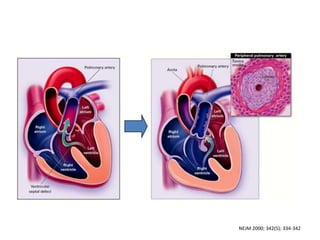 NEJM 2000; 342(5); 334-342

 