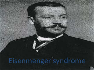 Eisenmenger syndrome
 