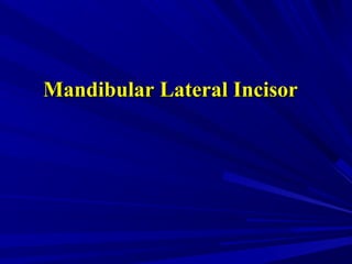 Mandibular Lateral IncisorMandibular Lateral Incisor
 