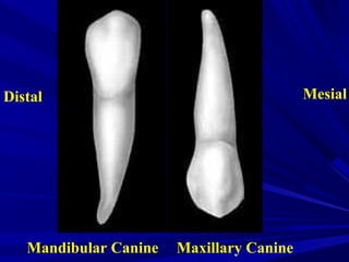 MesialDistal
Mandibular Canine Maxillary Canine
 