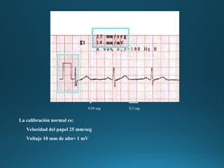 Seg Normal Definition Interpretación y Parámetros del Electrocardiograma para Diagnóstico ...