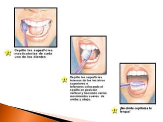 TÉCNICA DE CEPILLADO
